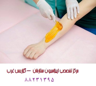 مرکز اپیلاسیون غرب تهران