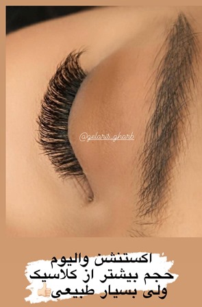 کاشت مژه هیبریدی